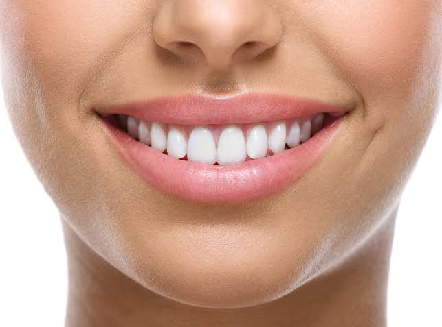 Smile Designing